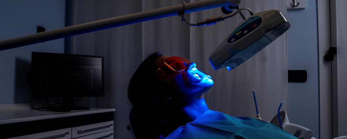 sbiancamento denti caivano