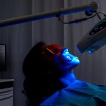 Lo sbiancamento dentale 3 sbiancamento denti caivano