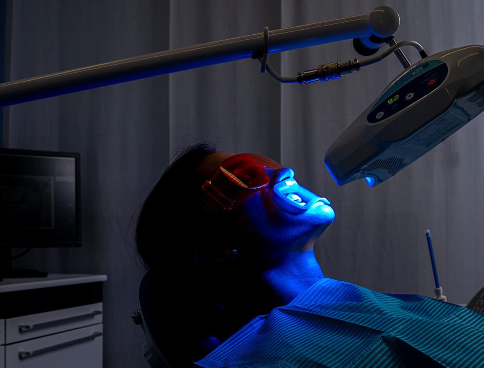 sbiancamento denti caivano